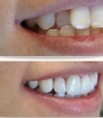 /album/cosmetic-dentistry/cosmatic-dental-4-jpg/